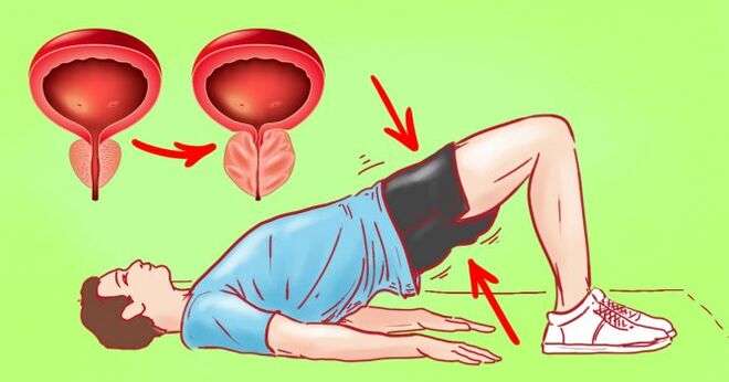 prostatit